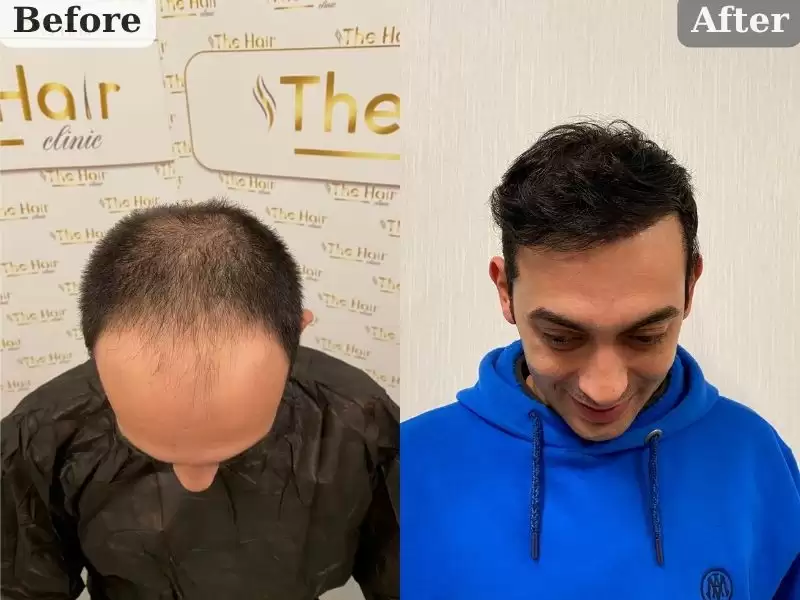 hiyuseinkinari-1-nian-huseyin-kinali-1-yil