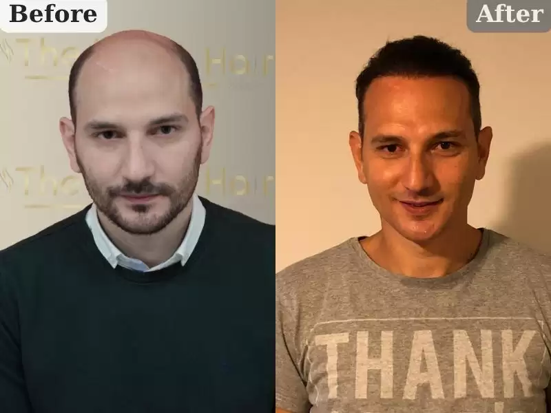 iruhanshi-2-nian-jian-2setusiyonnojie-guo-ilhan-bey-2-yil-2-seans-sonucu