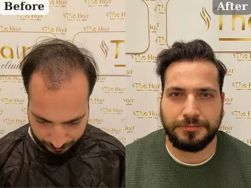 10-07-23-ahumetutotaitupuarusuran-10-07-23-ahmet-tayyib-arslan