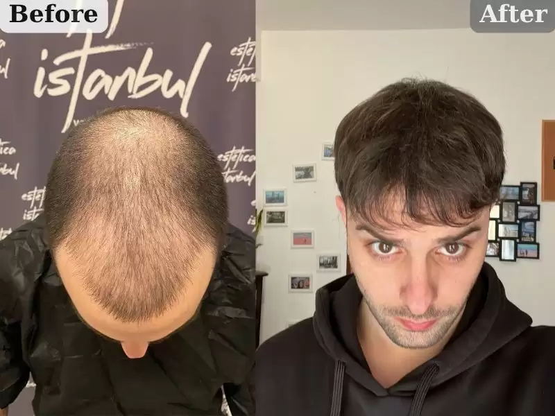 2023-nian-7-yue-14-ri-marukopaterunosutoro-14-07-2023-marco-paternostro