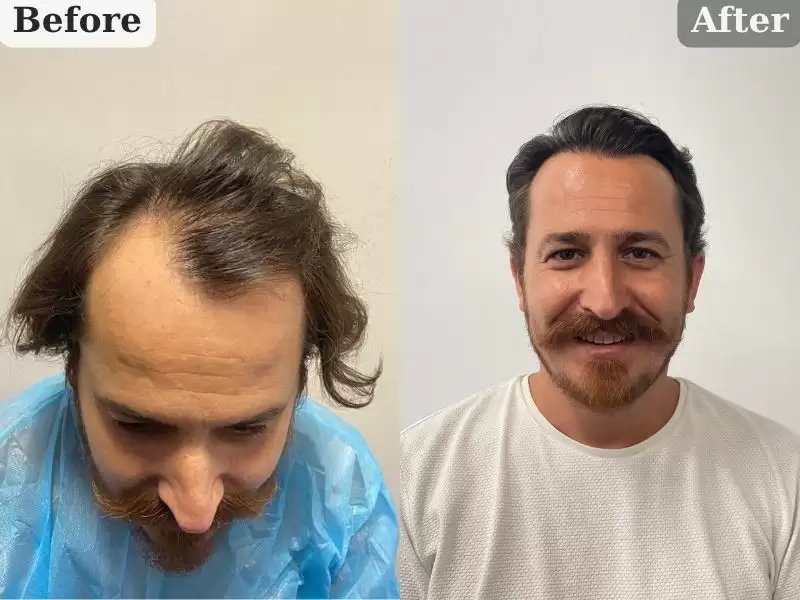 2-nian-10keyue-2-til-10-ayy