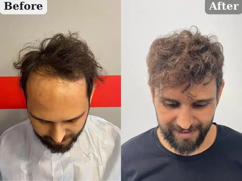 2-nian-10keyue-hou-2-yil-10-ay-sonra