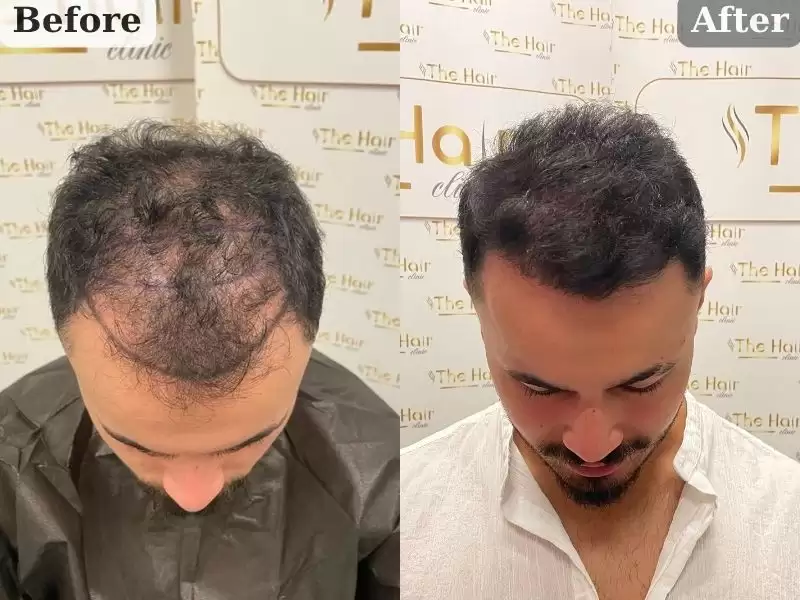 wu-bai-wu-shi-wu-555