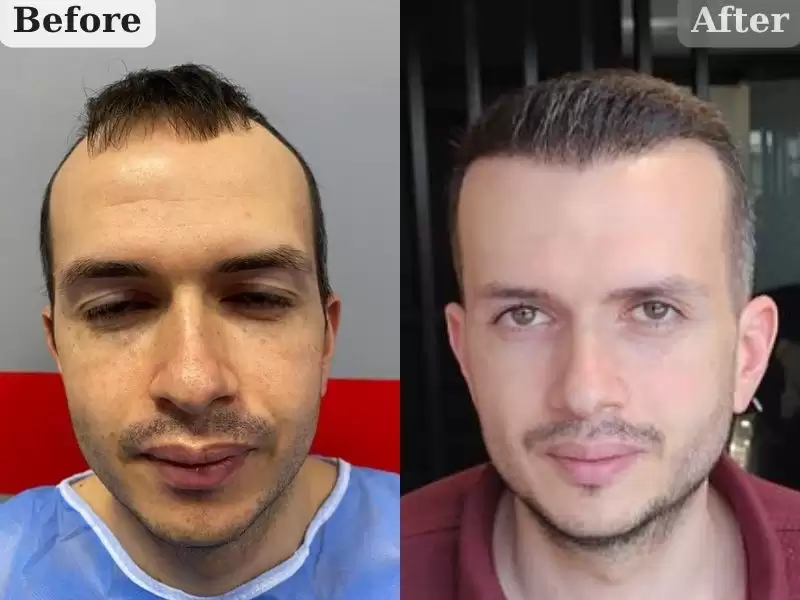 huiratutosan-6keyue-firat-bey-6-ay