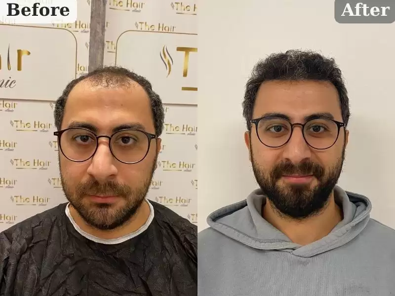 yusuhuyazuti-8keyue-yusuf-yazici-8-ay