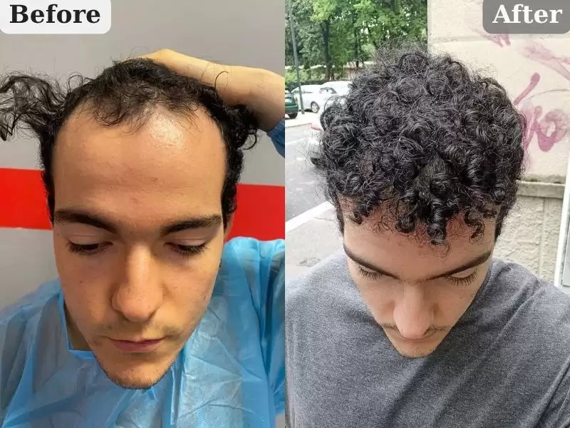 itariaren-nohuan-zhe-nizarusan-sheng-hou-8keyue-italyan-hasta-nizar-bey-8-ay