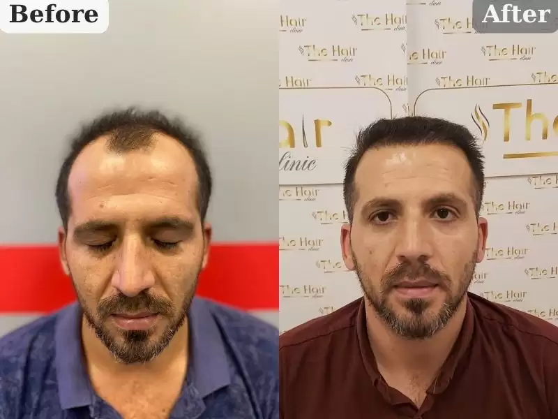 aihansan-9keyue-mu-ayhan-bey-9-ay