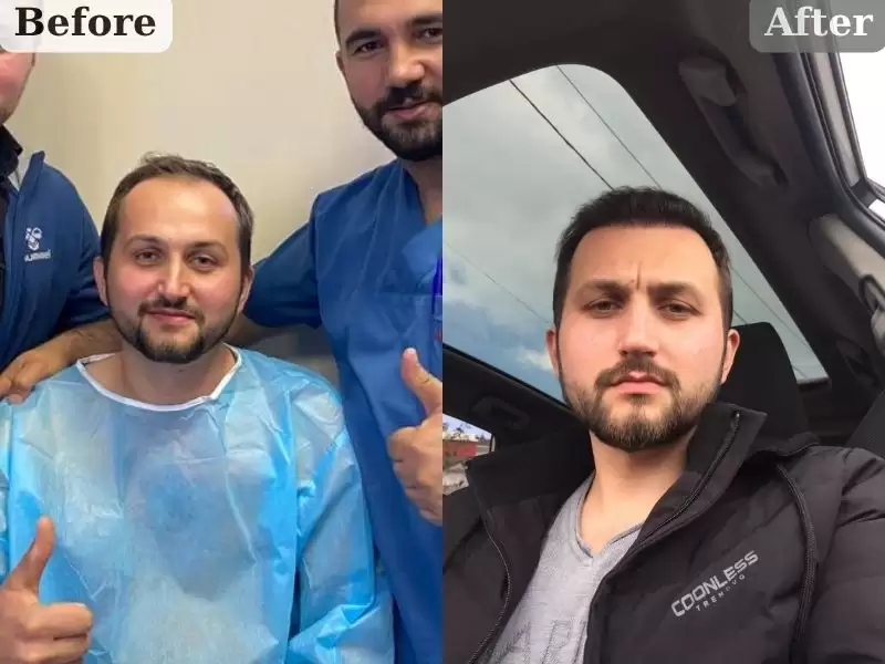 doansanhasheng-hou-7keyue-desu-dogan-bey-7-ay