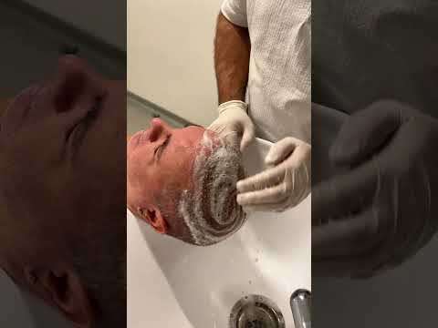 saçekim,saç ekim köpükleme,saç ekim yıkama