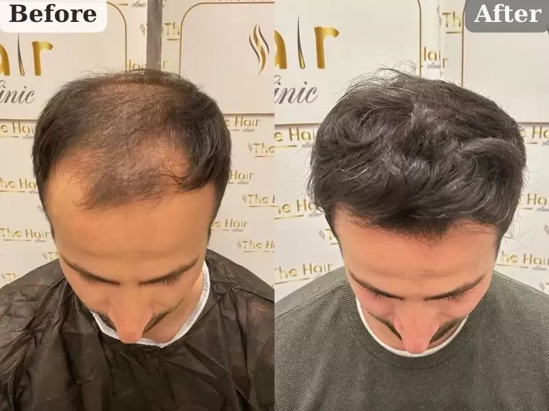 emuranojie-guo-14keyue-emrah-sonuc-14-ay