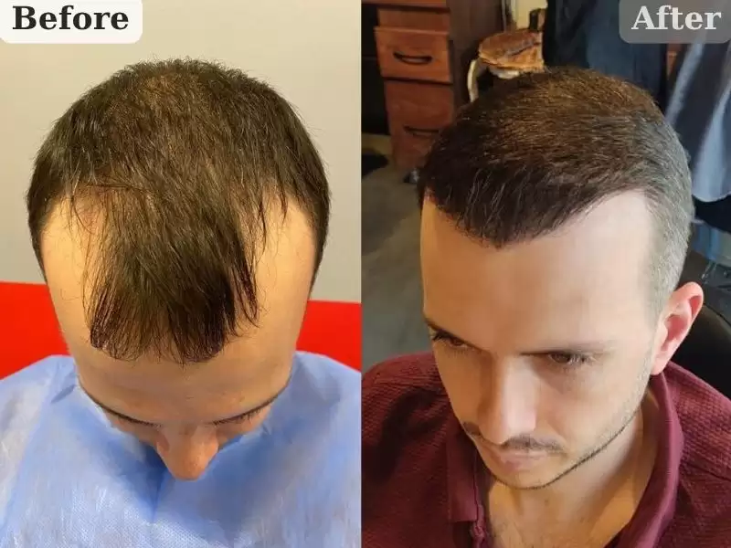 huiratoshi-6kayue-firat-bey-6-ay