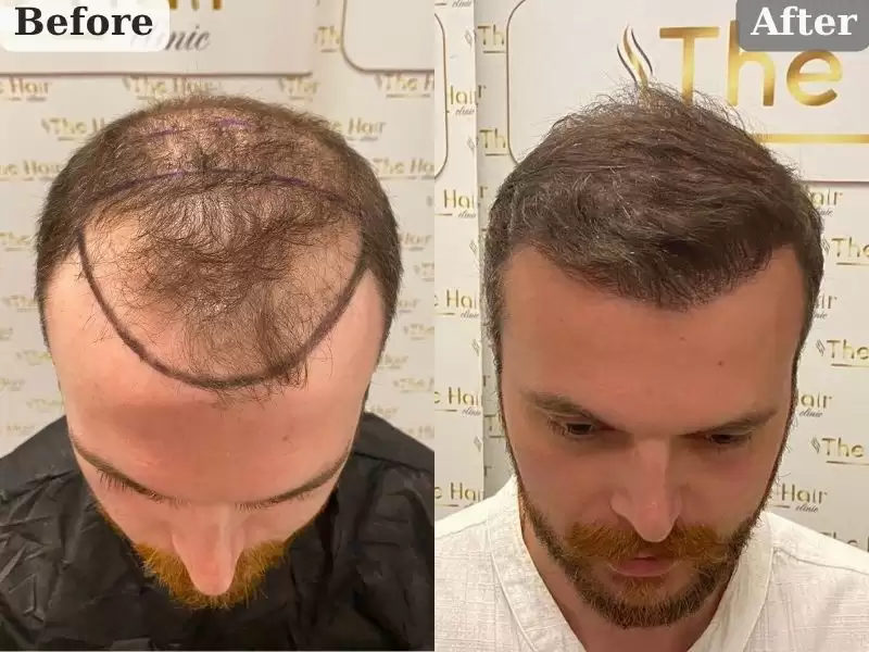 hiyuseinhosiyugoru-7-5keyue-huseyin-hosgor-7-5-ay