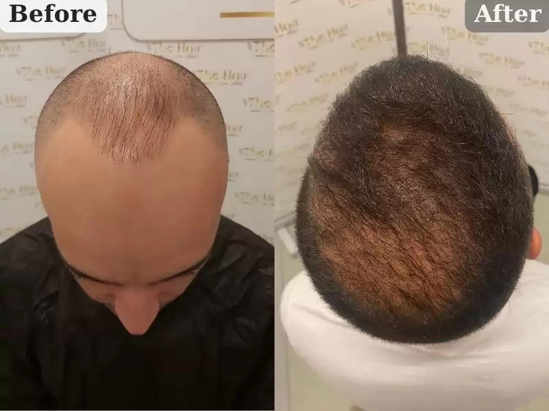 sezuginakubiituku-1-nian-4keyue-sezgin-akbiyik-1-yil-4-ay