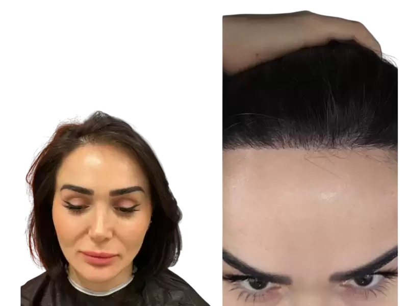 nu-xing-xiang-kezhi-mao