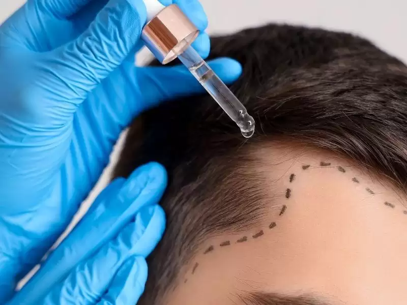 torukozhi-mao-nomerituto