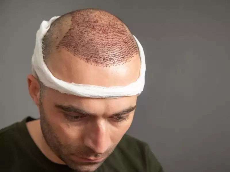 zhi-mao-hou-nokasabutanotuo-luo