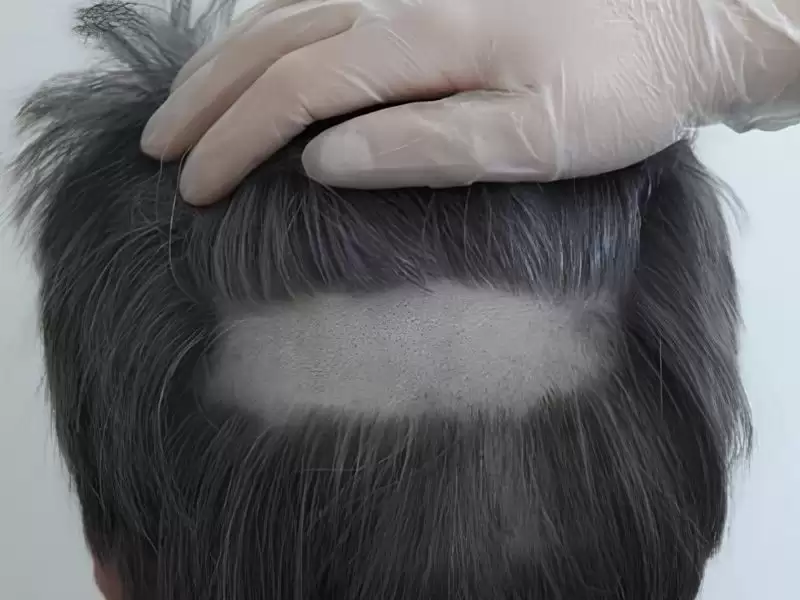 siebinguhurinozhi-mao