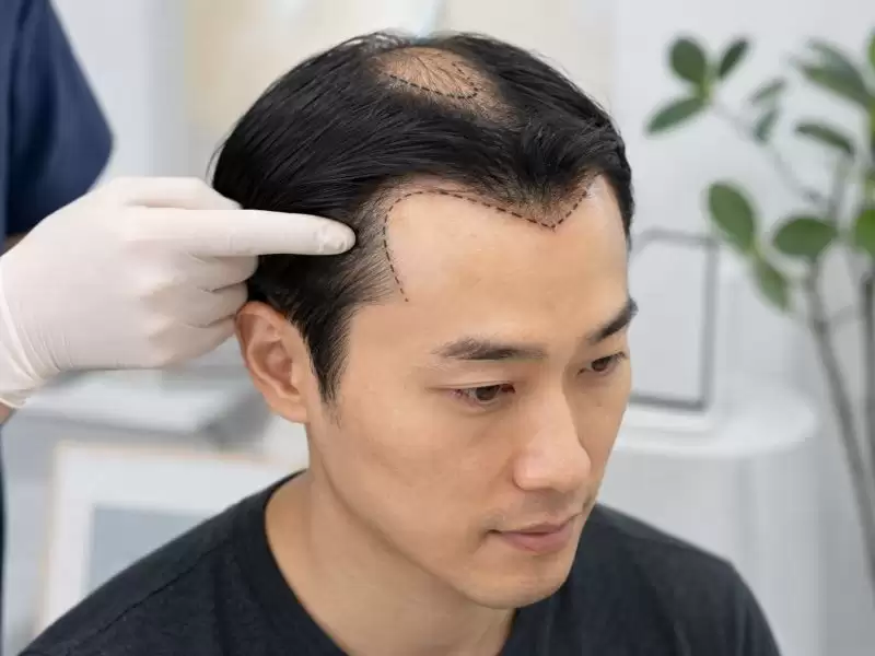 zi-mao-zhi-mao-hahe-gurahutobi-yao-m-zi-sheng-eji-tou-ding-bu-nomu-an